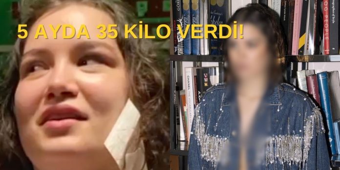 5 Ayda 35 Kilo Verdi: Yeni Halini Görenler Gözlerine İnanamadı!